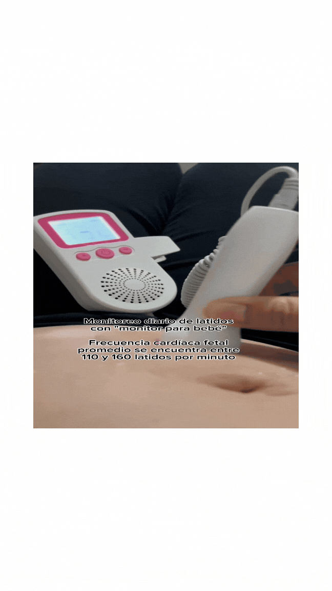 Doppler Fetal Audifono Cardiaco Bebes, PAGO CONTRA ENTREGA